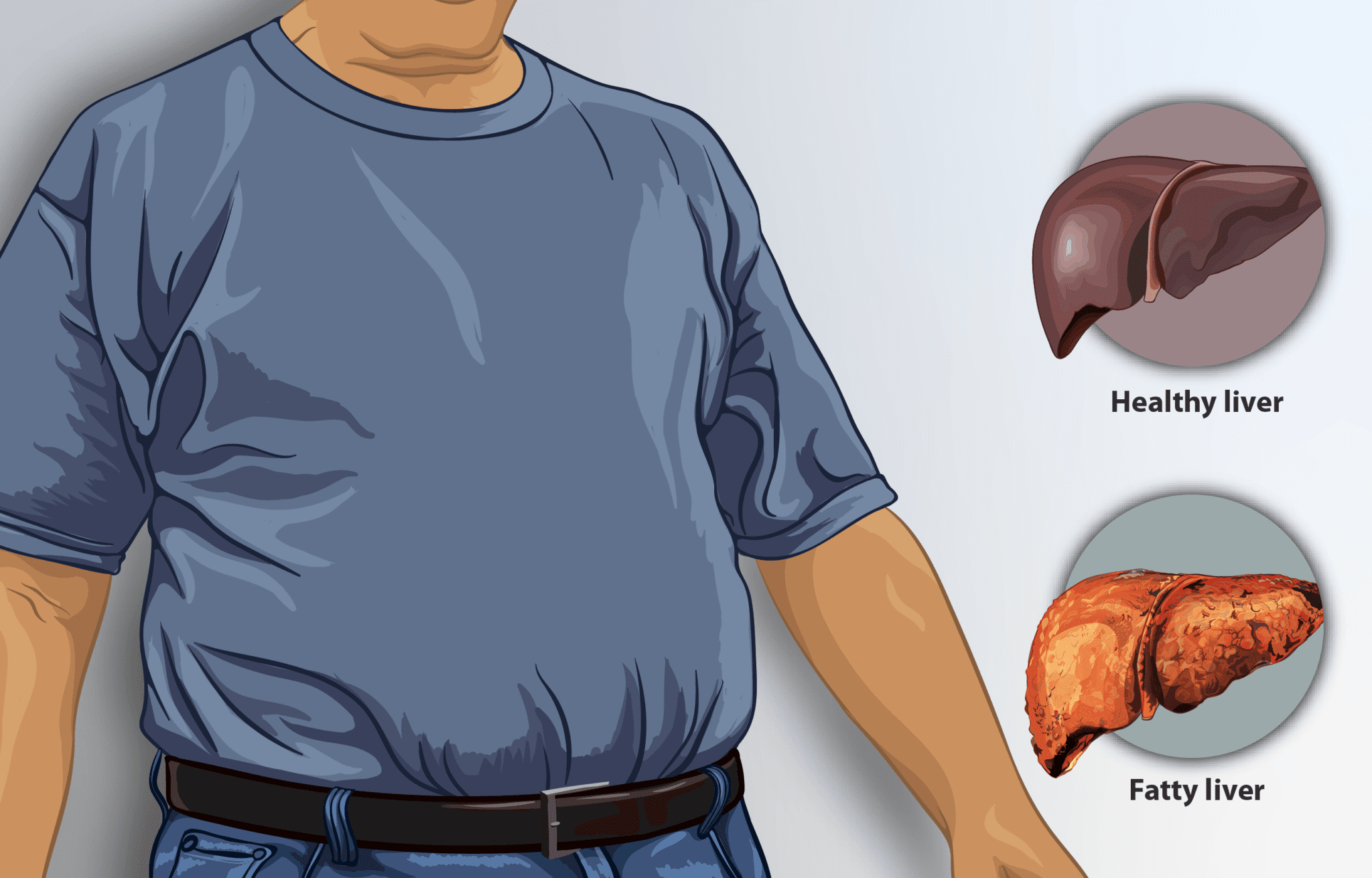 do-you-have-a-fatty-liver-here-s-how-to-get-rid-of-it