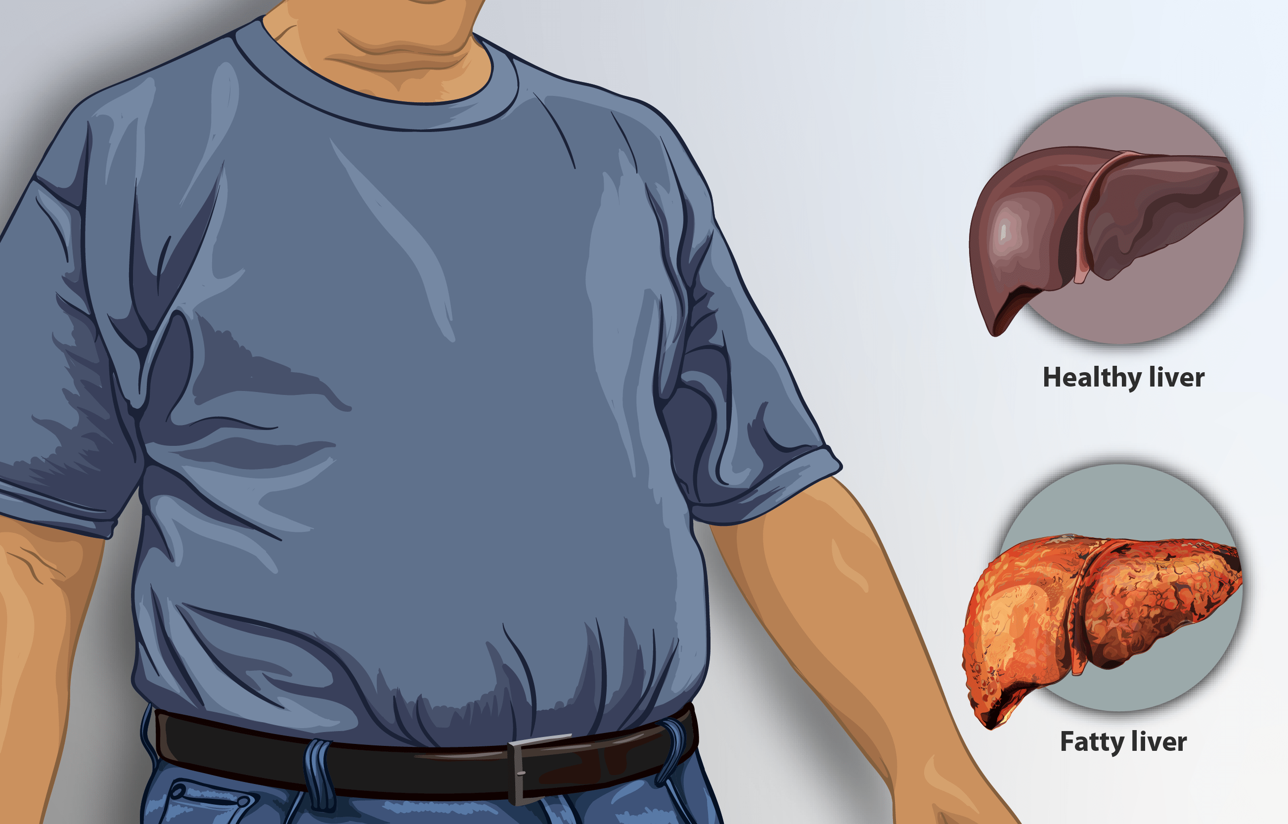 Do You Have A Fatty Liver? Here’s How To Get Rid Of It